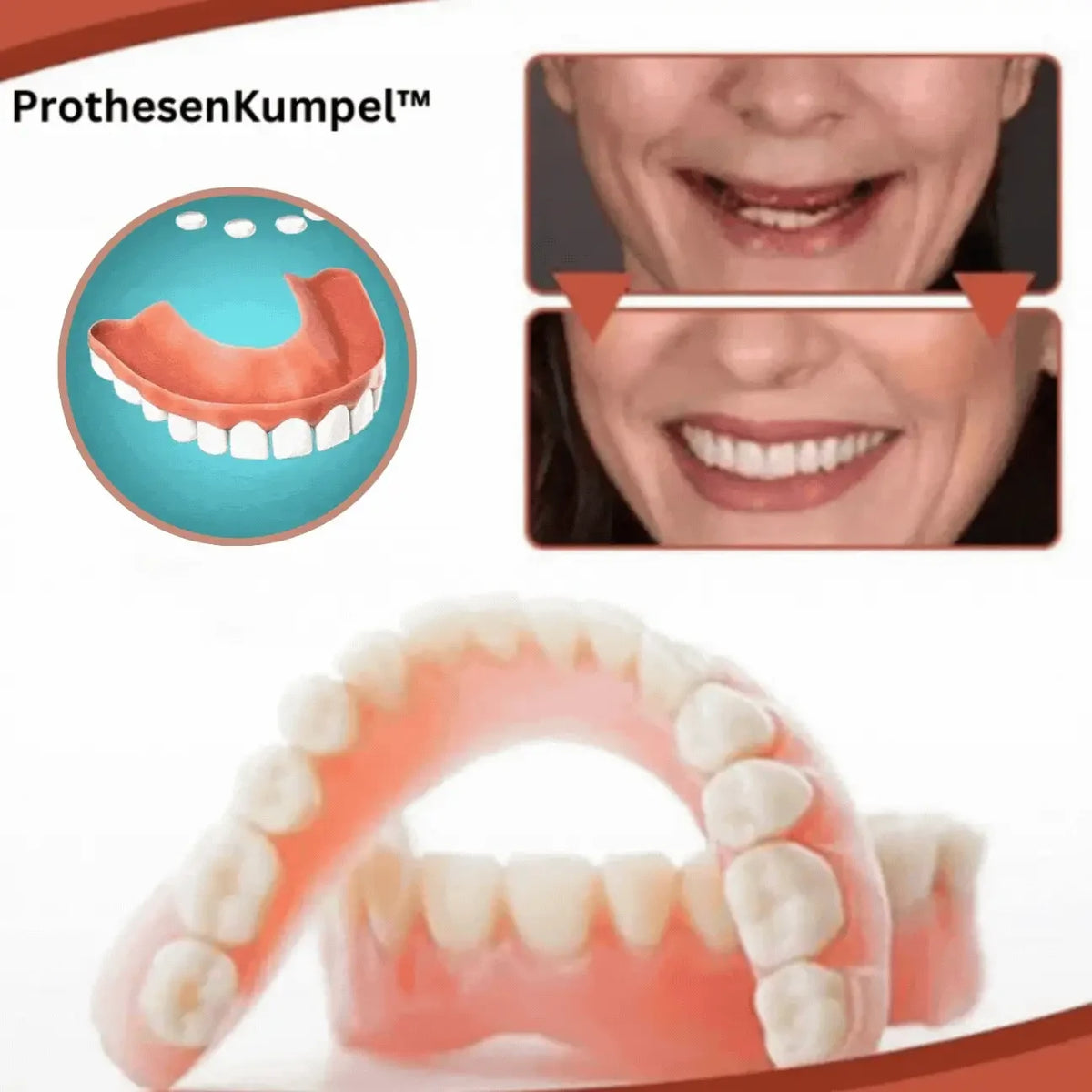 Snap on Veneers Custom Fit Moldable Teeth with Artificial Gums and Storage Case - Image 4